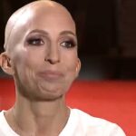 Rubint Réka döbbenetes vallomása: évek óta daganatos betegséggel küzd, a kezelések miatt a haját is elveszítette