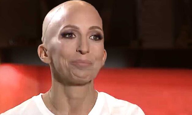 Rubint Réka döbbenetes vallomása: évek óta daganatos betegséggel küzd, a kezelések miatt a haját is elveszítette