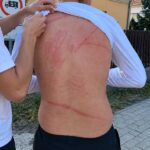 Brutális támadás Pilisen: Botokkal és faágakkal vertek véresre egy 15 éves fiút, a polgármester rendőrségi fellépést követel